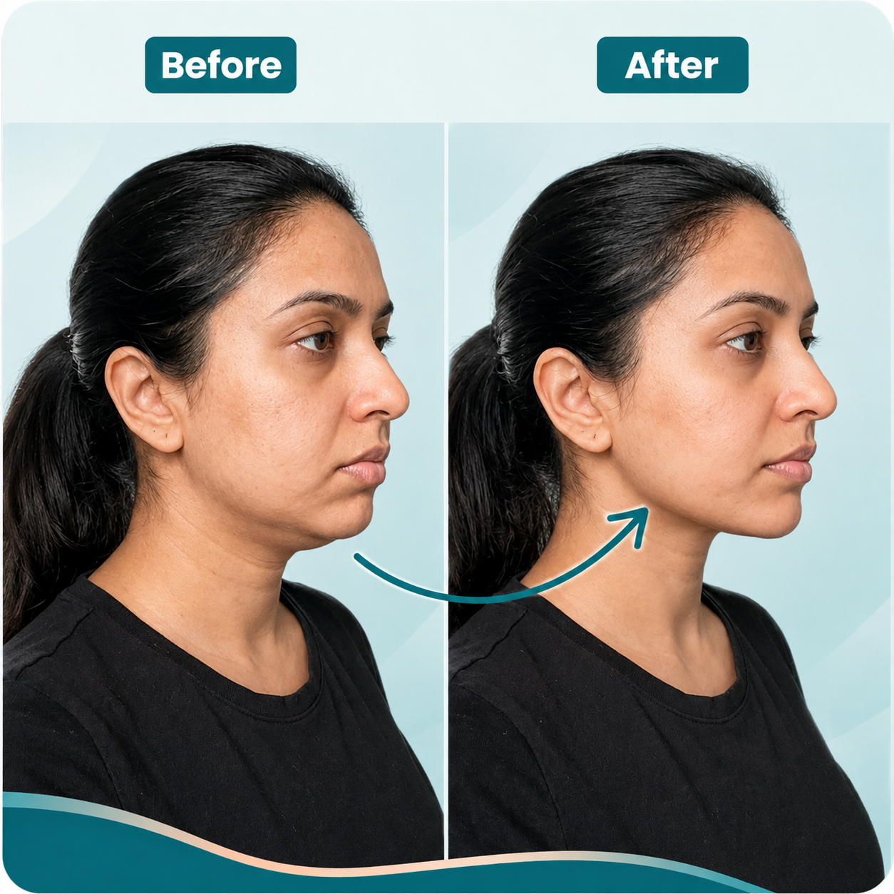 ✨Premium Lymphatic Drainage Facial Brush